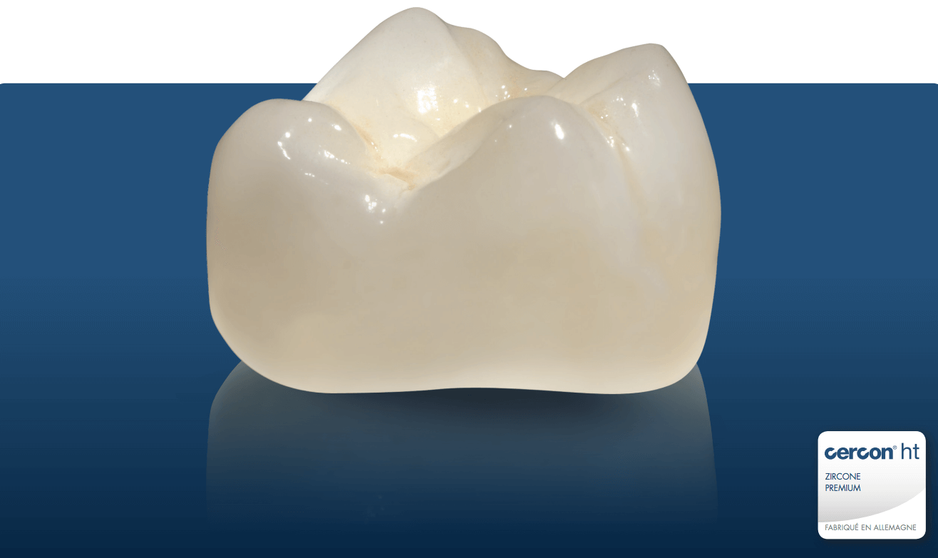 La Cercon HT est une zircone premium, matériaux de choix sélectionnée par le laboratoire Prodontec